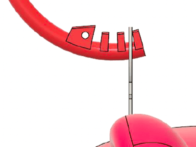 Cリング設定キットの難易度調整